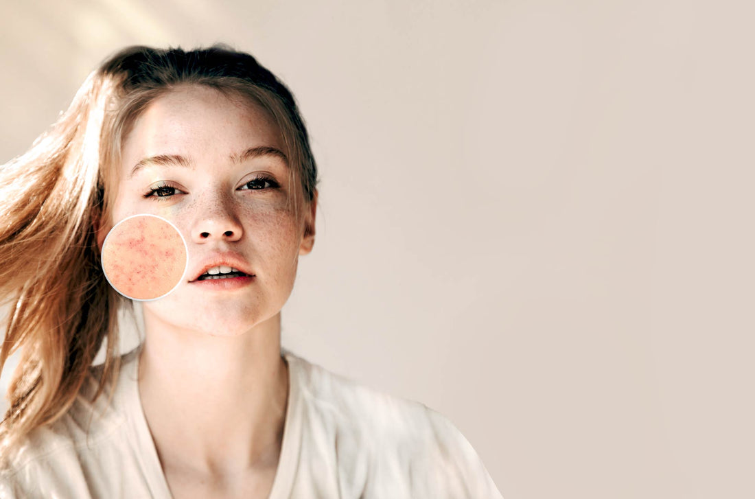 Wie verändert sich die Haut im weiblichen Zyklus?